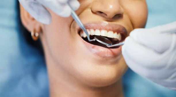 Best Emergency Dental Care for Broken or Chipped Teeth in Cary, NC
