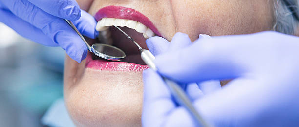 Best Urgent Care for Lost Fillings or Crowns in Cary, NC